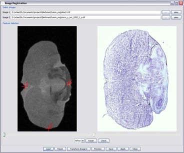 MR Imaging and Immuno-Histological Data 1