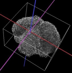 3D visualization of the MRI data