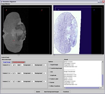 MR Imaging and Immuno-Histological Data 2